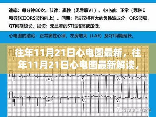 小红书带你解读最新心电图，探索健康心跳之旅