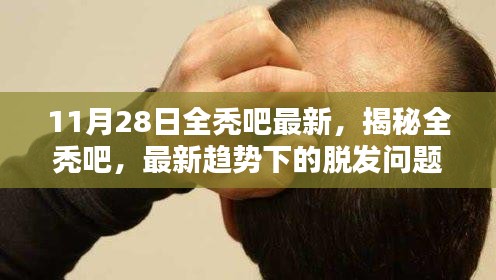 揭秘全秃吧最新趋势，深度探讨脱发问题及其解决方案