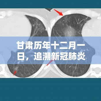 甘肃历年十二月一日新冠肺炎足迹与影响回顾